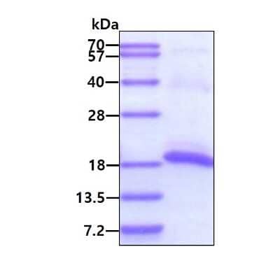 SDS-Page: Recombinant Human PPP3R2 His Protein [NBP1-51059] - 3ug by SDS-PAGE under reducing condition and visualized by coomassie blue stain.